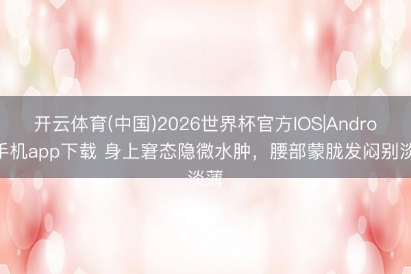 开云体育(中国)2026世界杯官方IOS|Android手机app下载 身上窘态隐微水肿，腰部蒙胧发闷别淡薄